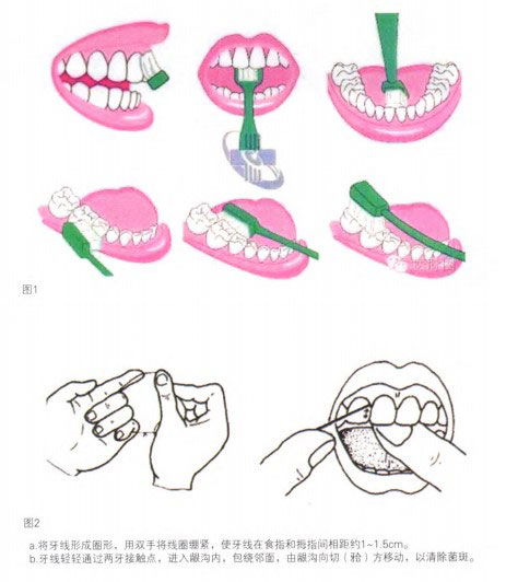 刷牙方法示意圖